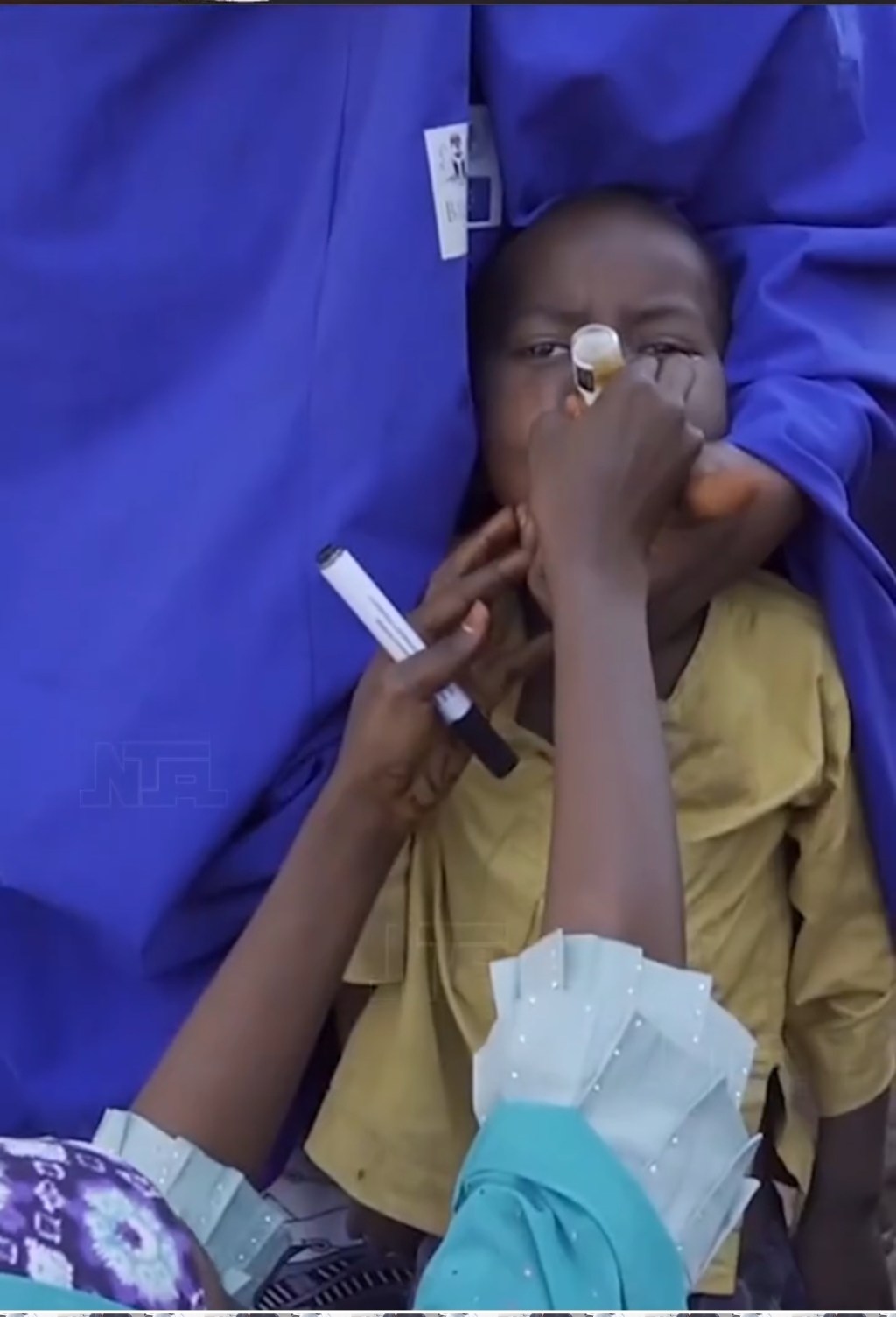 Borno Launches Major Immunization Push to Shield Thousands of Children from&nbsp;Disease